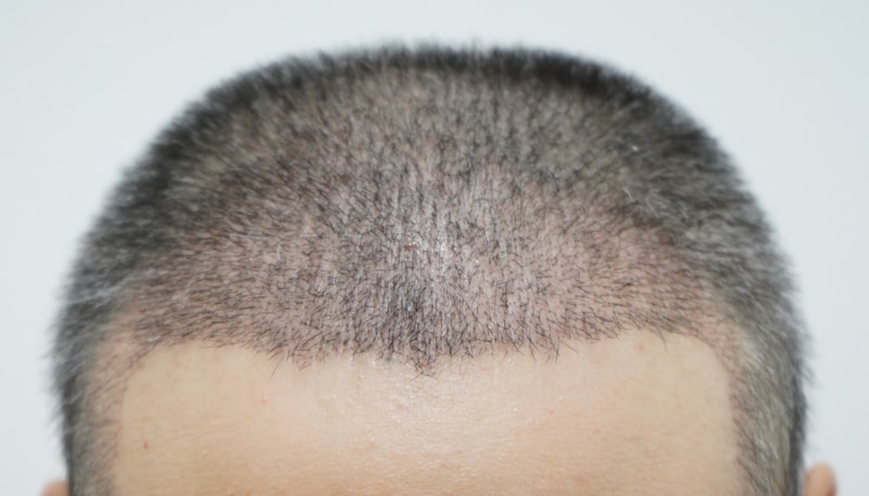 포토후기 이미지