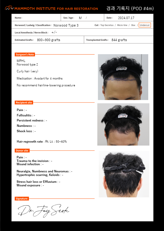 Apgujeong Mammoth Hairline Clinic Men M-shaped Non-Cutting Hair Transplantation in 4th Months