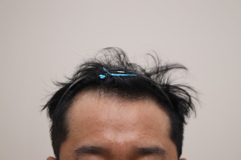 1. 수술전_1.JPG
