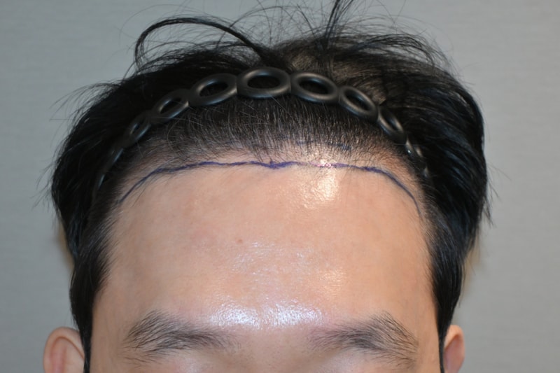 수술전 (2).jpg