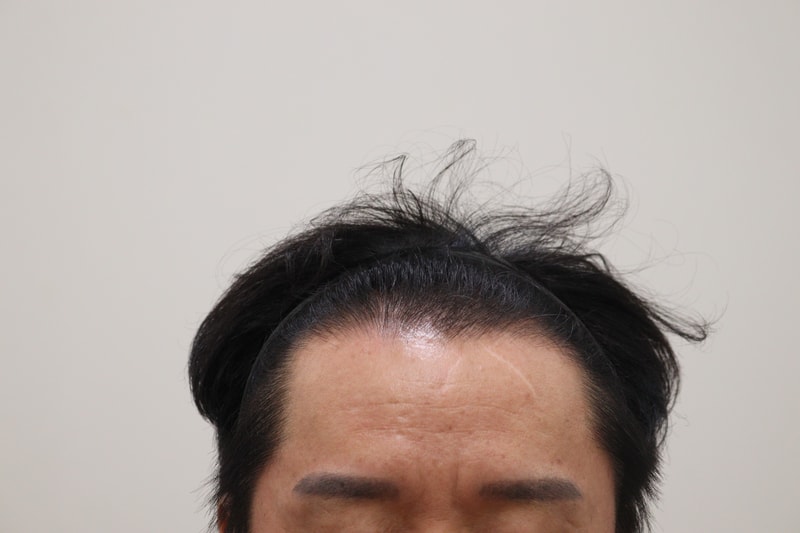1. 수술전_1.JPG