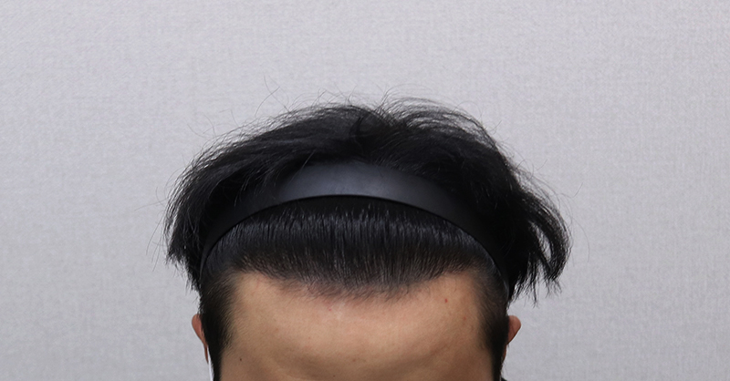 5. 2년4개월 경과.JPG