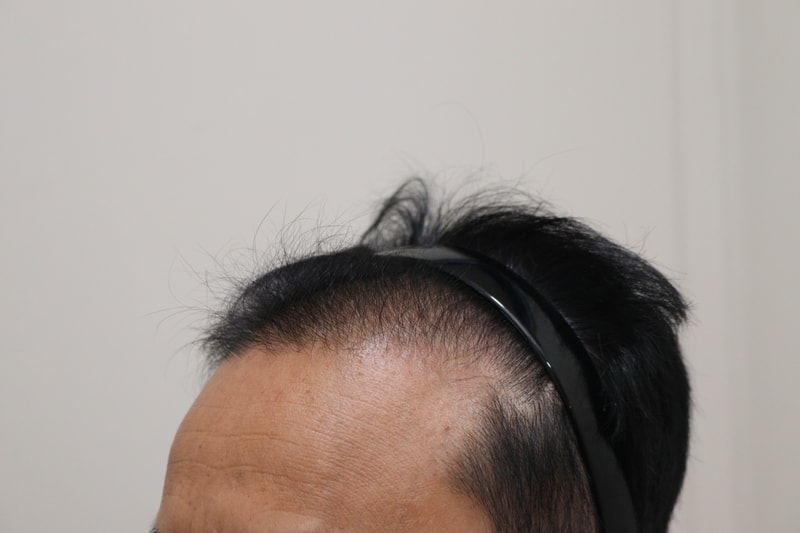 1. 수술전_2.JPG