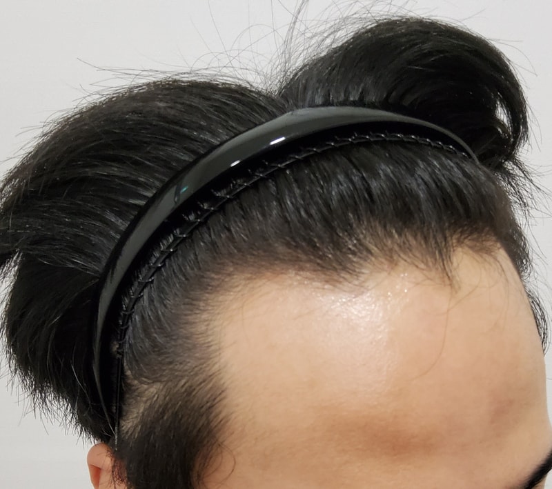 1. 수술전_4.jpg