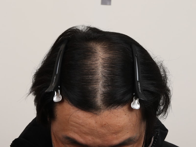 1000032433.jpg
