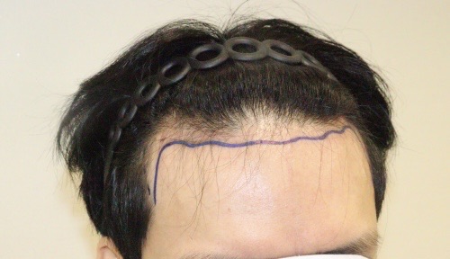 before2.jpg