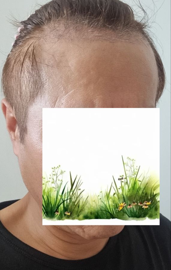 00000.jpg