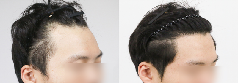 모우림 2.png
