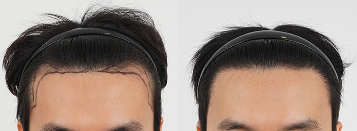 포토후기 이미지