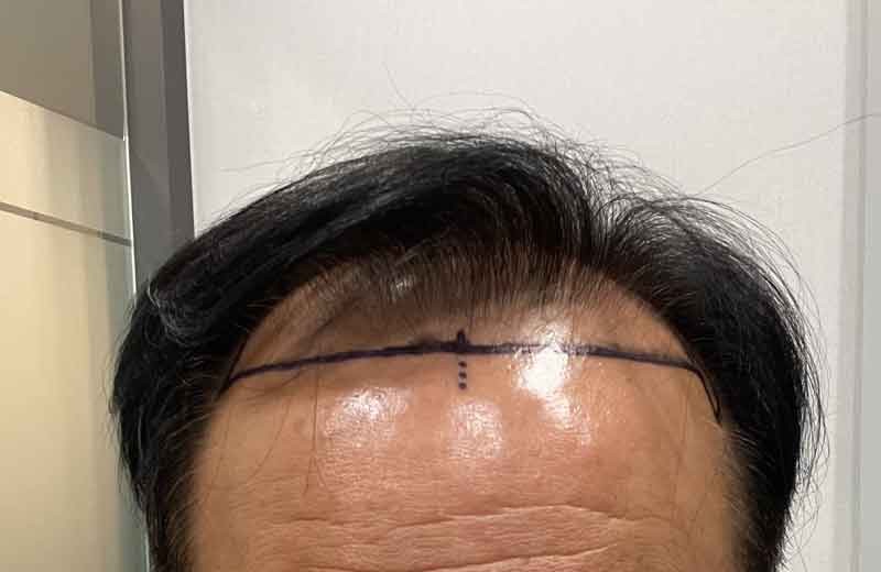 수술전의모양.jpg