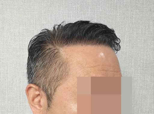 수술후^^.jpg