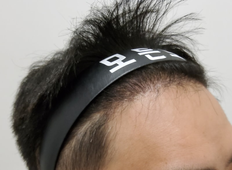 4. 수술후_6개월_3.jpg
