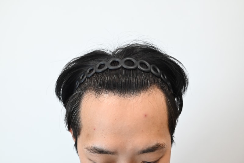 비절개 3100모 1일차 후기