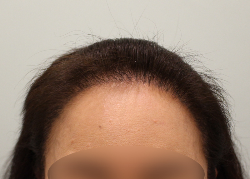 03.jpg