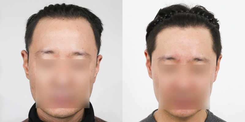 포토후기 이미지