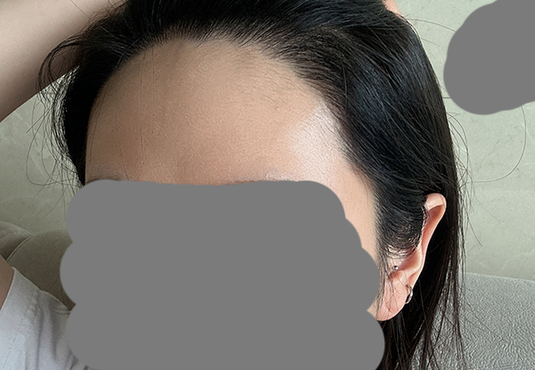 5 머리 안 감아서 떡진 걸 감안하고 봐주세요 ㅎ.jpg