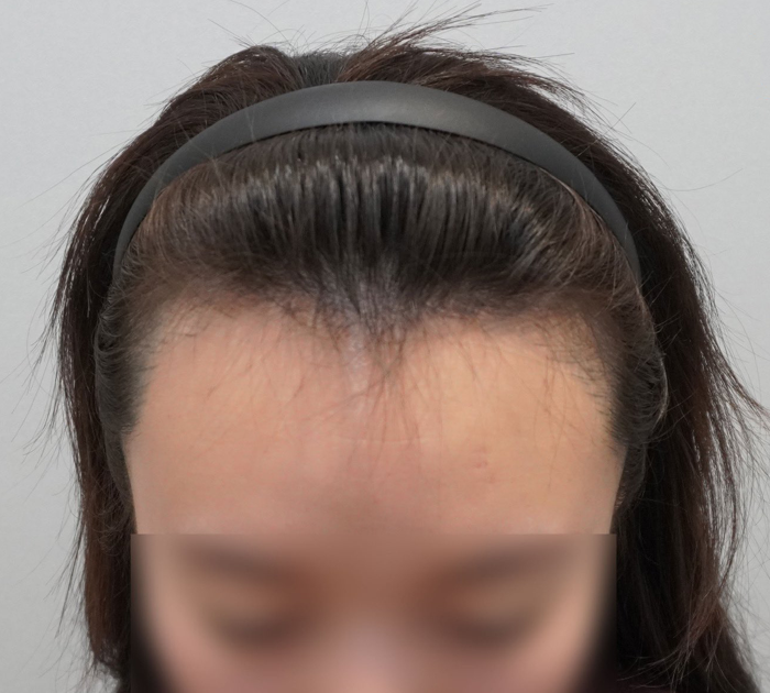 포토후기 이미지