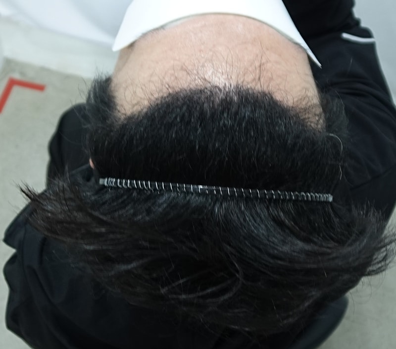 포토후기 이미지