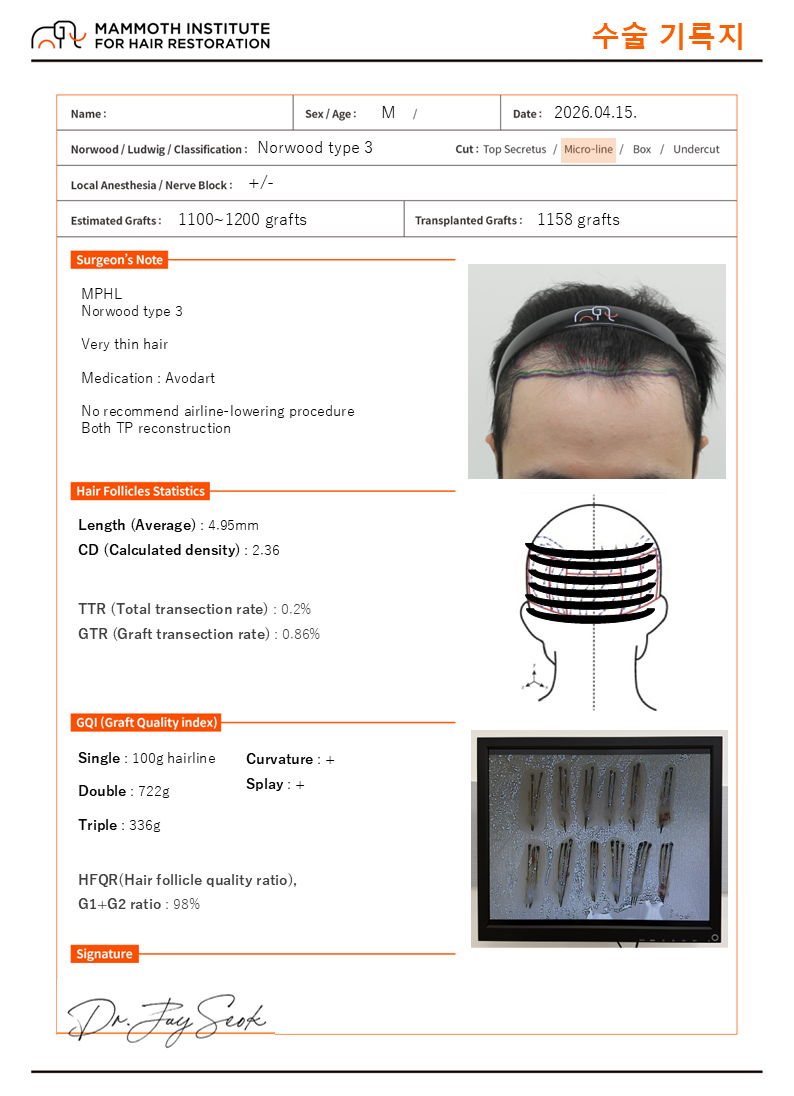 압구정 맘모스 사파이어 슬릿 모발이식 당일 후기