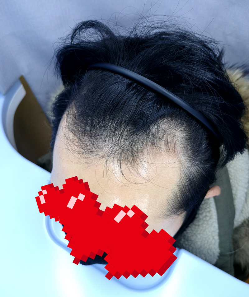 맹귀현89 수술전2.png