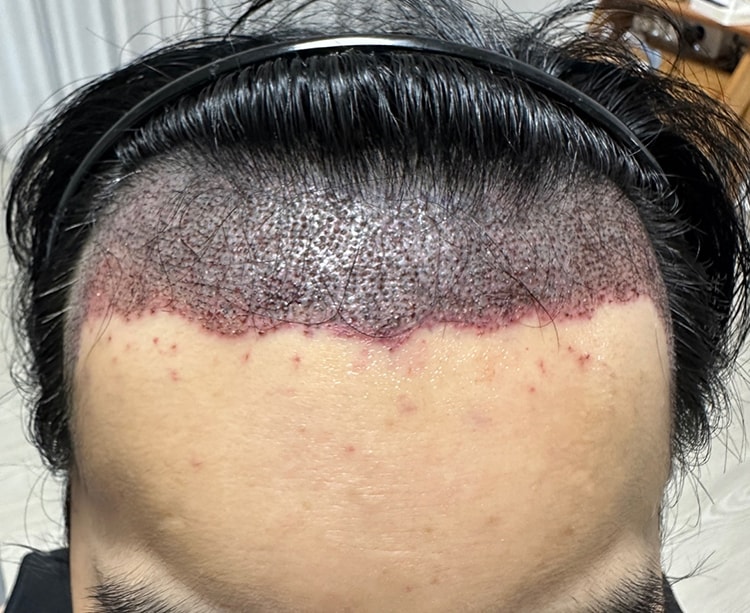 结束长达18个月的旅程，发表最后的感想。