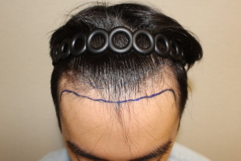 포토후기 이미지