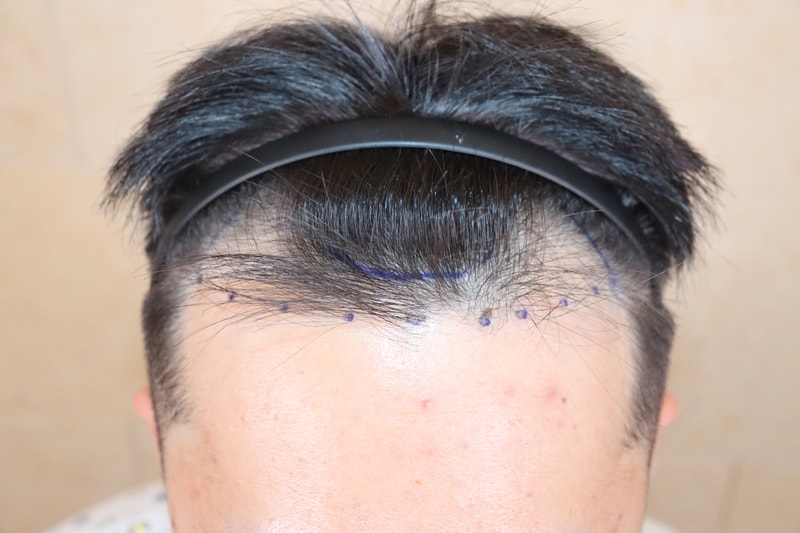 포토후기 이미지