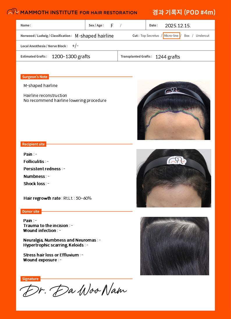 포토후기 이미지