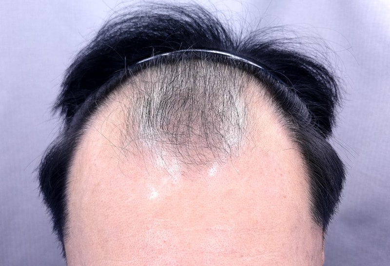 포토후기 이미지