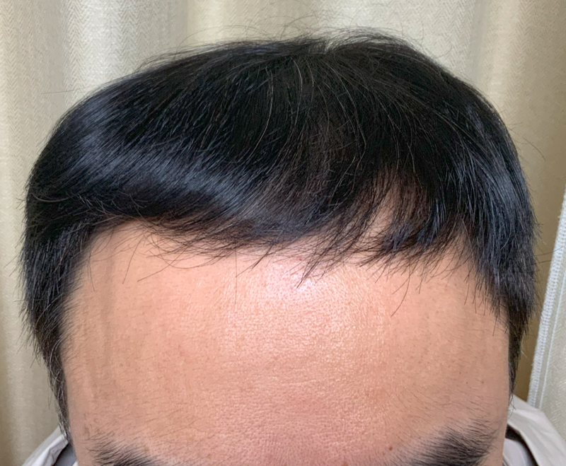 포토후기 이미지