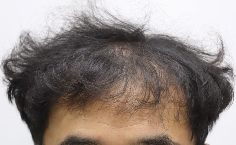 포토후기 이미지