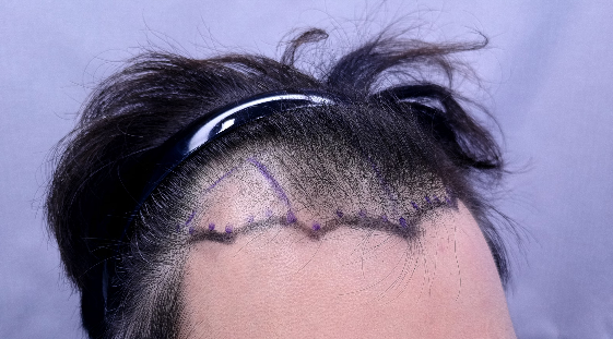 포토후기 이미지