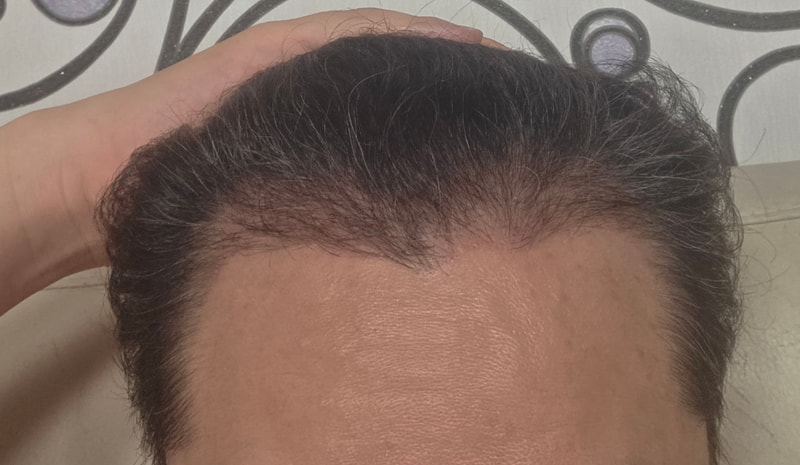 1000015628.jpg
