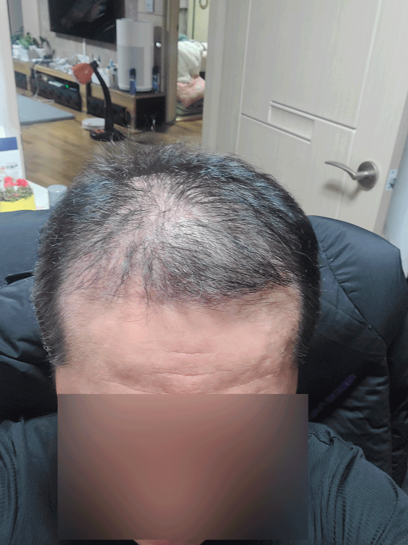 KakaoTalk_Photo_2025-12-22-18-20-37_04_.gif