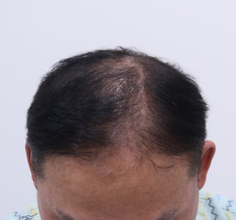 1. 수술전_2.JPG