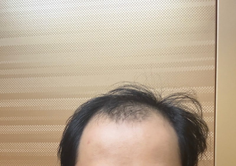 헤이아치 소생기 7개월차