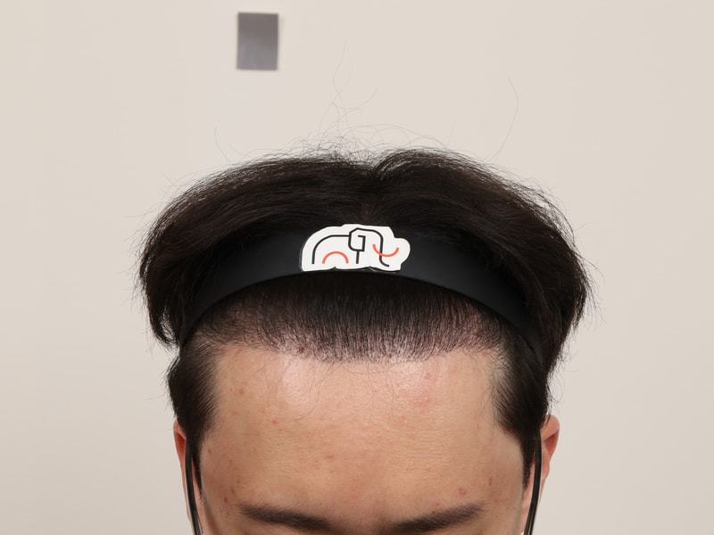 후.jpg