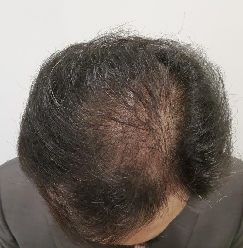 3. 수술후_3개월_4.jpg