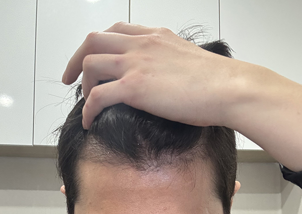 7-암흑기에 안 빠졌던 머리들은 그대로 자라는게 넘나 신기함.jpg