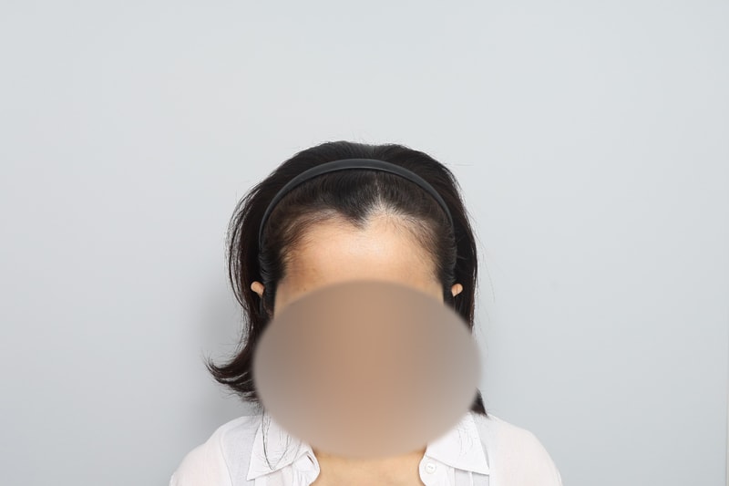 수술전1.jpg