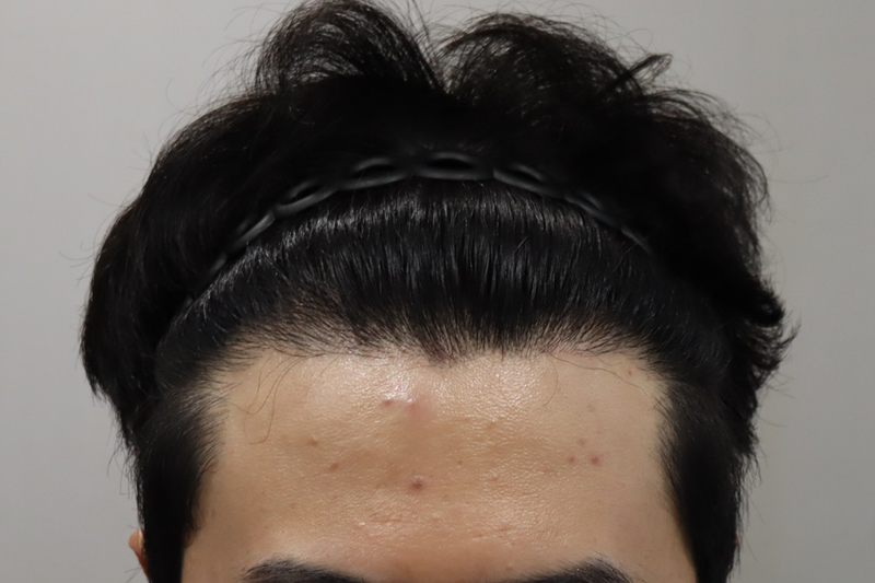 1.png