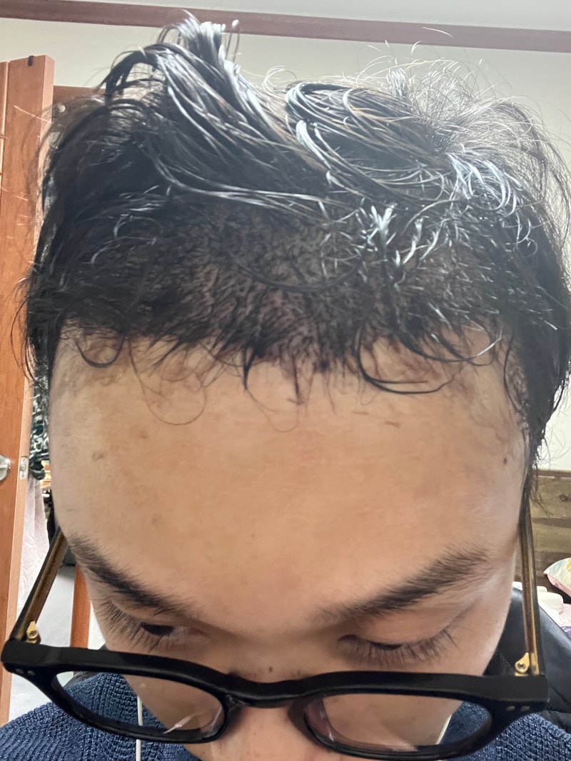 후.jpg
