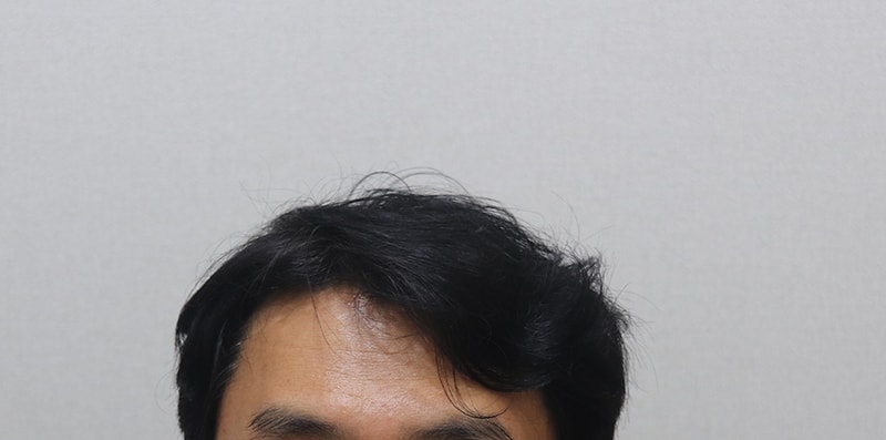 10. 1년10개월 헤어스타일.JPG
