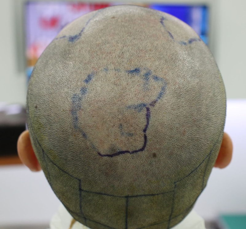 06.정수리디자인.JPG