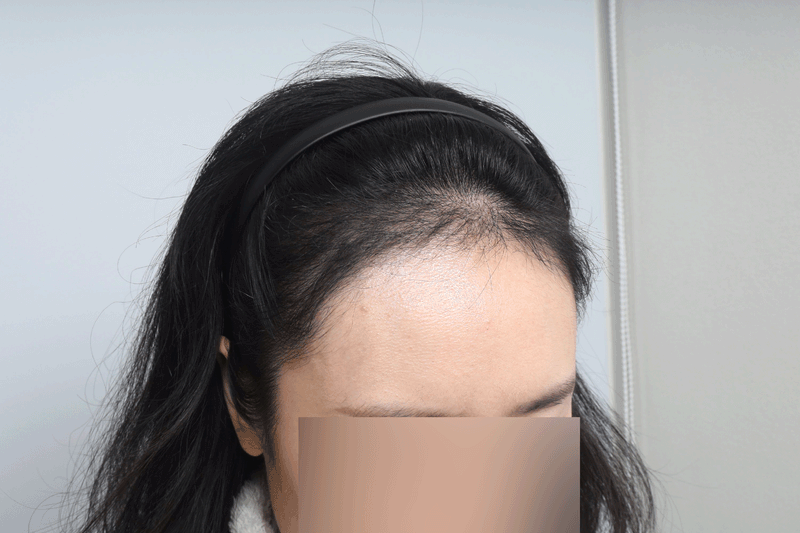 ㅈ5.gif