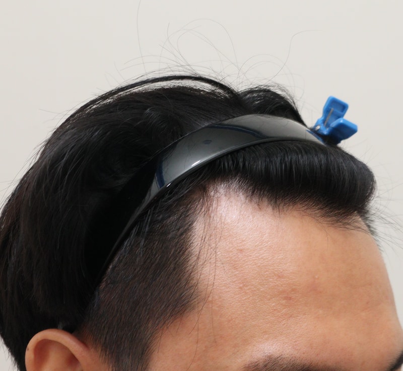 1. 수술전_3.JPG