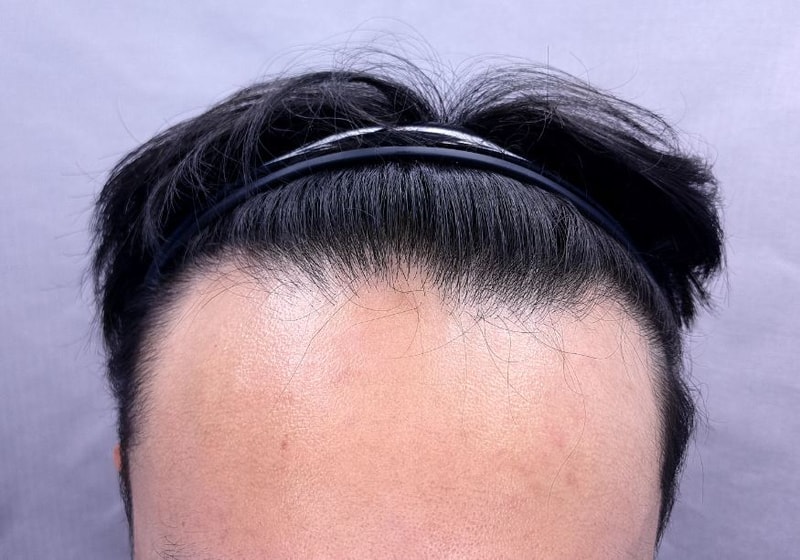 임지호 헤어라인 2300.JPG