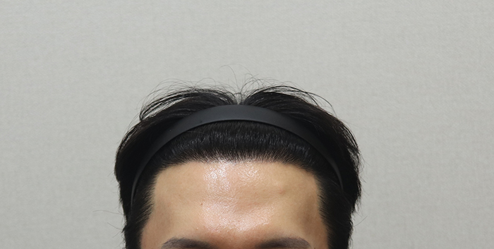 7. 최근 11개월 경과.JPG