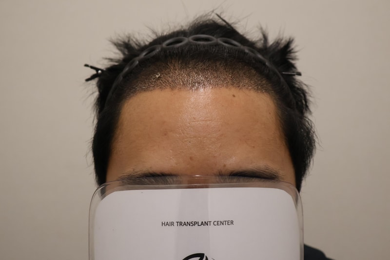 1000001645.jpg