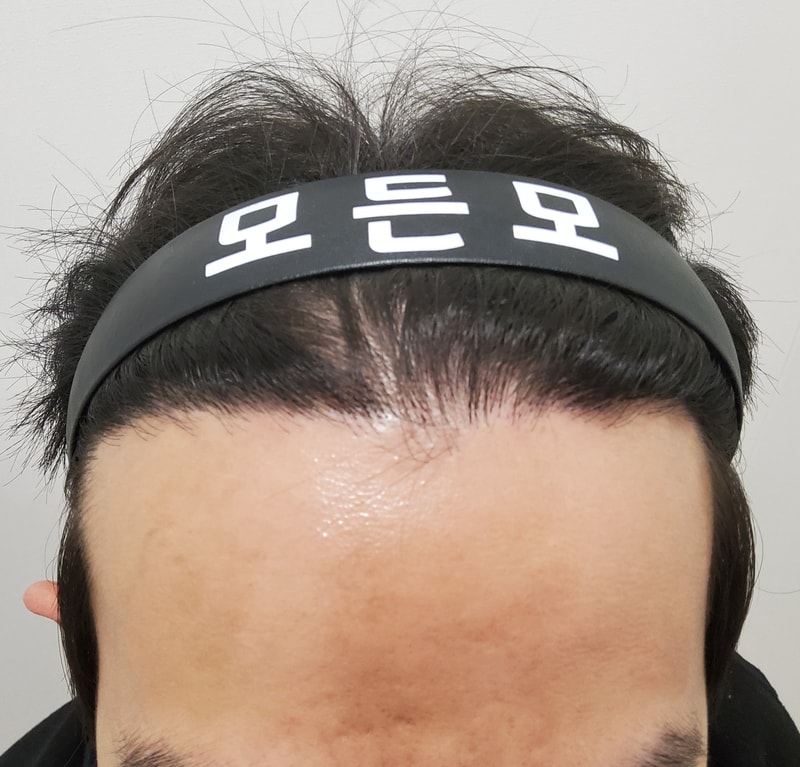 4. 수술후_1년_1.jpg